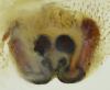 Larinioides sclopetarius